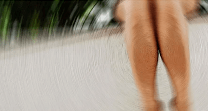 How to treat venous veins at home