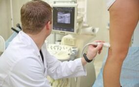 Treatment of varicose veins in the legs in women