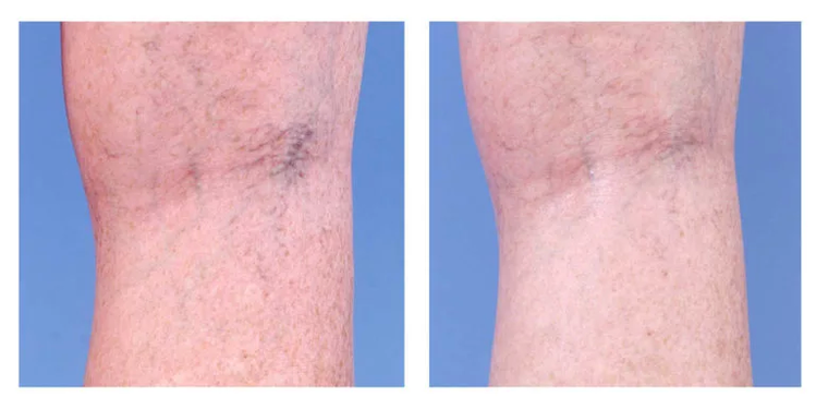 Aesthetic correction