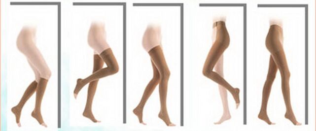 Compression hosiery for varicose veins